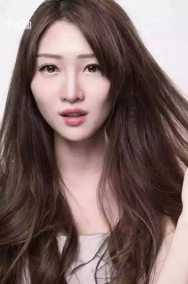 32岁创作型女歌手赴日本拍摄不慎被水蛭咬:最担心怕皮肤溃烂