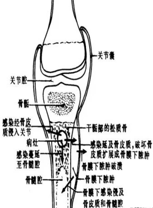 骨髓怎么读图片