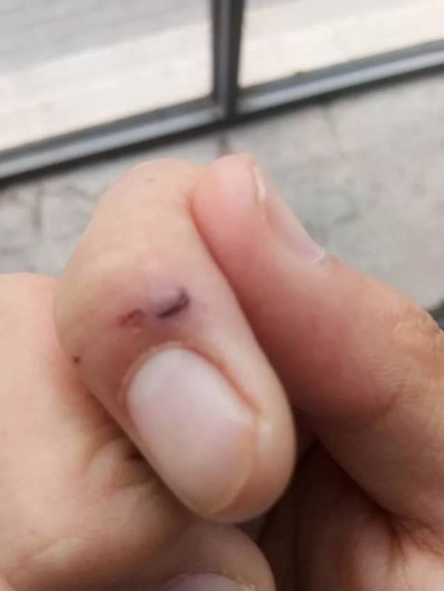 员工个人意外保险 个人买意外保险怎么买