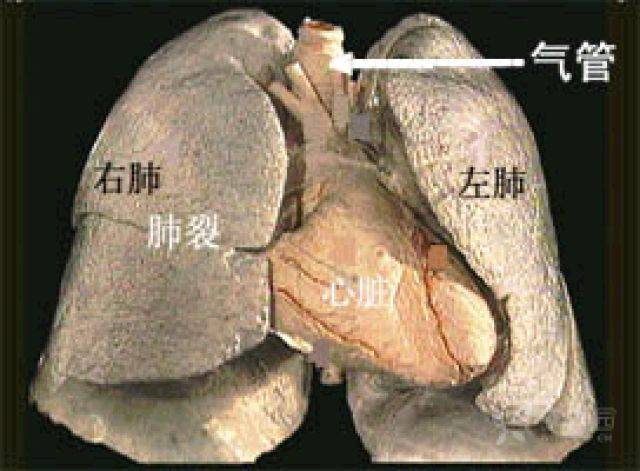 秒懂胸片！扒一扒胸片的基础知识_手机搜狐网