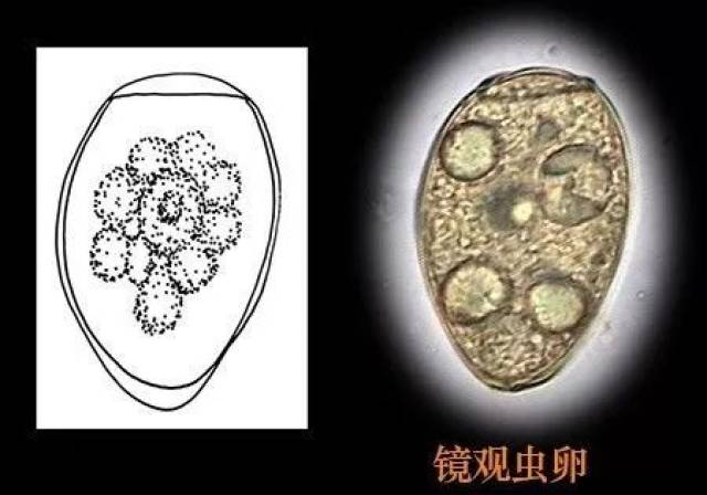 图片来源:我爱寄生虫 手绘:刘书耀 手绘虫卵与真实镜下虫卵对比