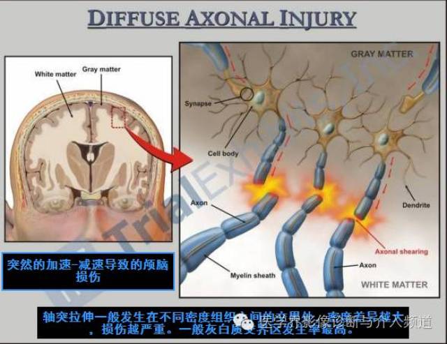 轴索再生图片