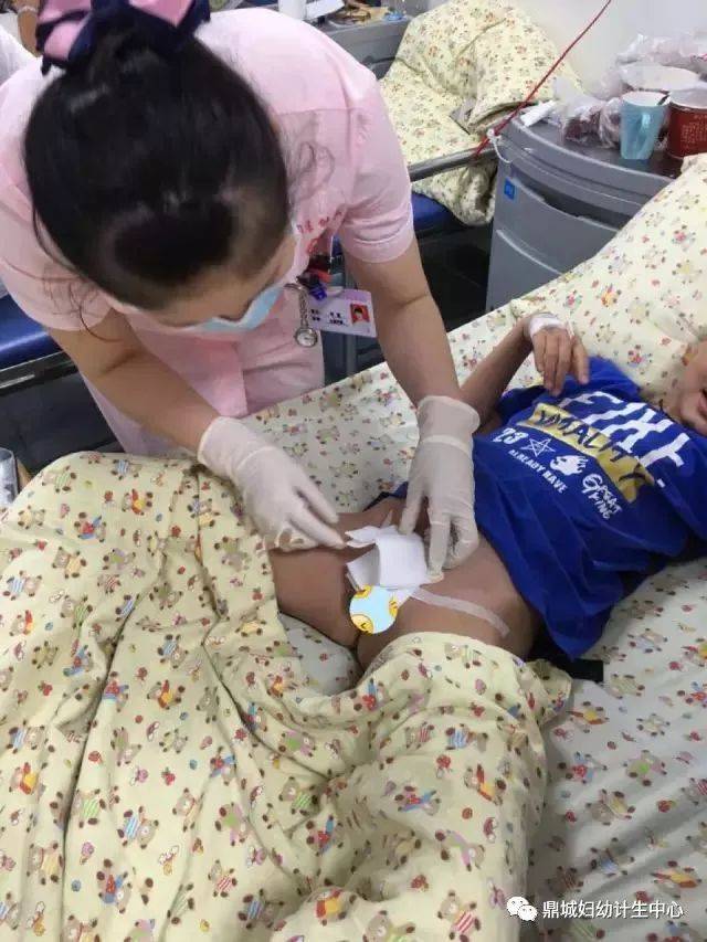 [父母必读]暑期——小儿包皮手术的最佳时机,您可千万别错过