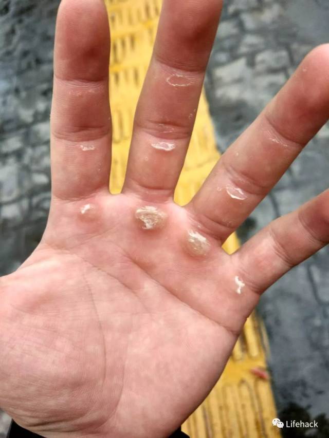 肌肉男的手,原来这么"丑"
