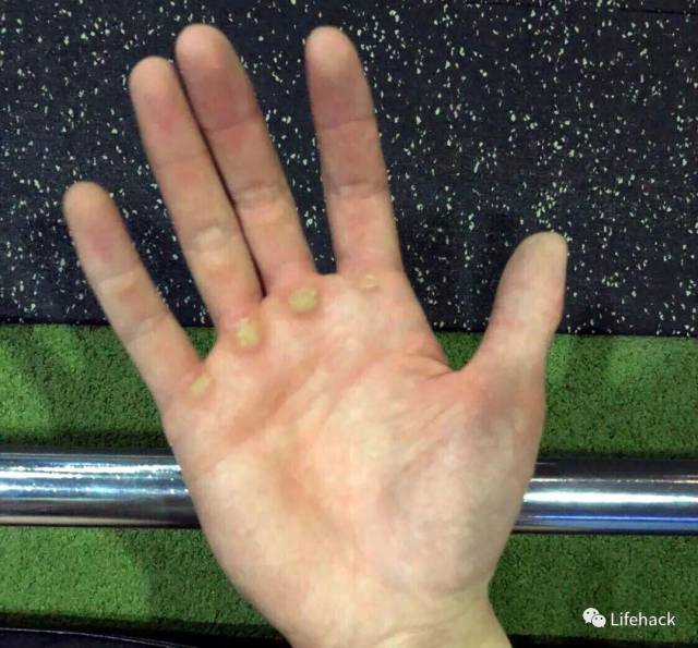 肌肉男的手,原来这么"丑"