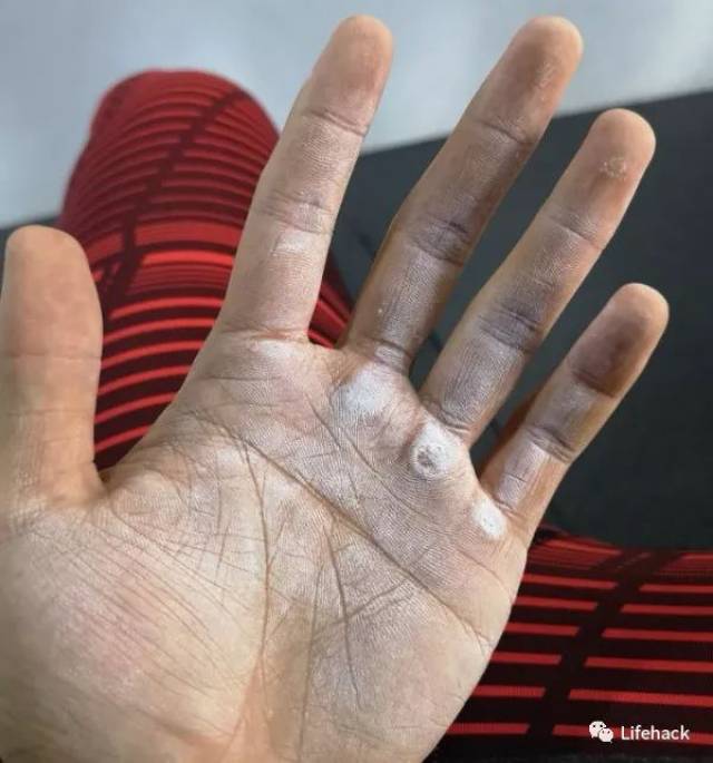肌肉男的手,原来这么"丑"