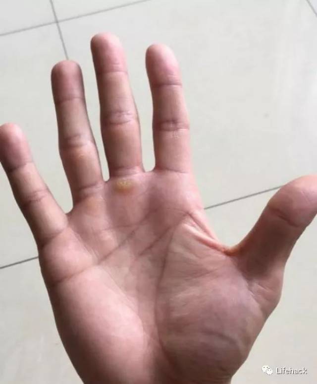 肌肉男的手,原来这么"丑"