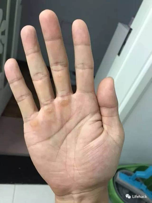 肌肉男的手,原来这么"丑"