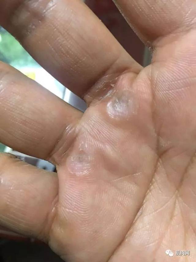 你只看到吴龙的肌肉,却没有看到他的手.
