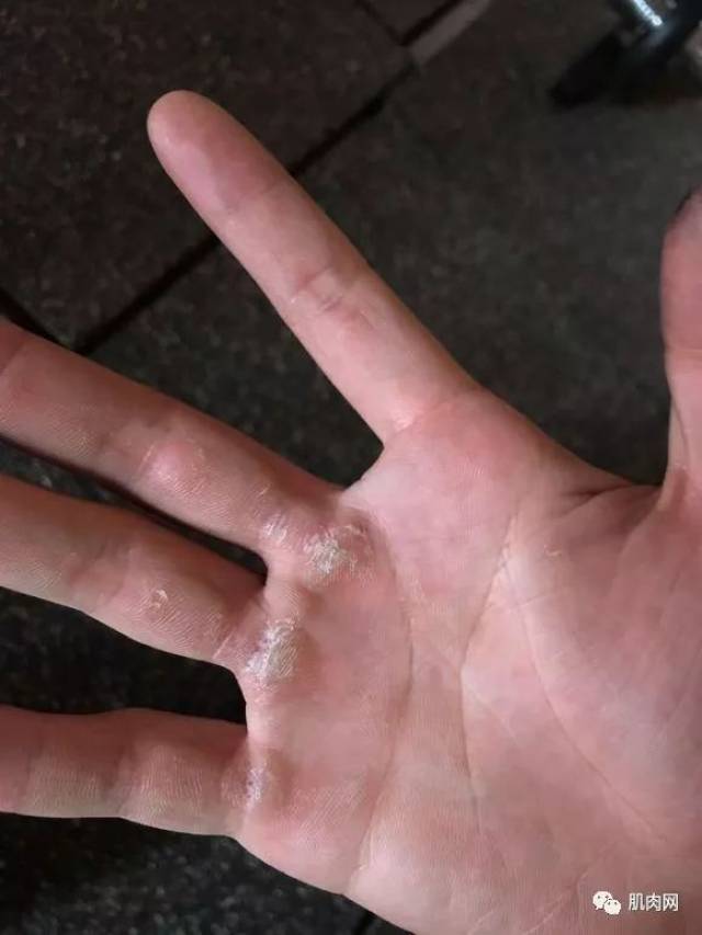 手天生的嫩 ▼ ▼ 手上没点茧子,都不好意思说自己玩健身