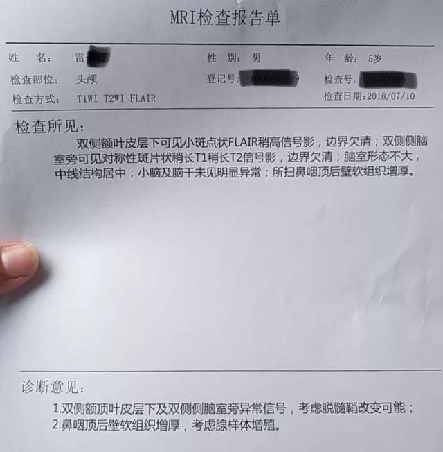 雙耳a型 助聽後行為測聽 該患兒佩戴助聽器後行為測聽,左耳言語頻率