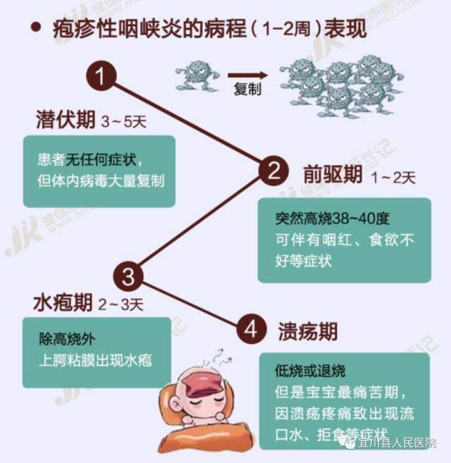 宜川分院公益微講堂——第二十七期丨寶寶得了皰疹性咽峽炎要如何護理