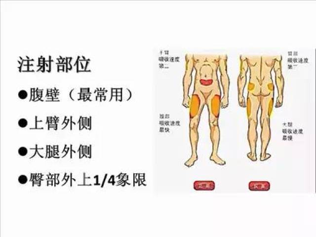 3/5 成人正常体重者可90度角进针,注射在腹部,注射在大腿部时最好