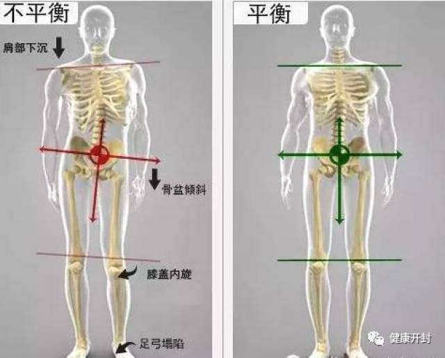 【脊柱側彎】有多恐怖你知道嗎?