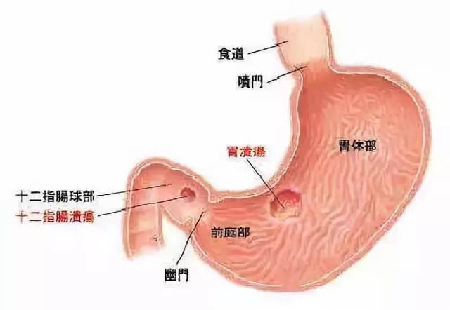 这5个征兆竟然是胃溃疡癌变，你有吗_手机搜狐网