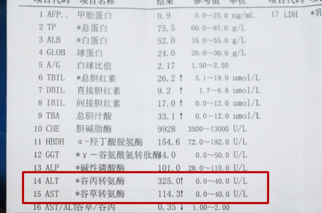 肝炎病變,轉氨酶亮紅燈,多喝這杯茶,及時調理降酶止損