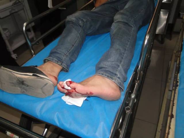 【现场】红星街突发车祸,男子被撞受伤!交警的判决亮了!