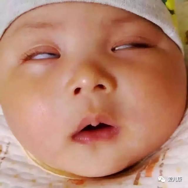 宝宝翻白眼的真相竟然是这样的!看完有人欢喜有人忧