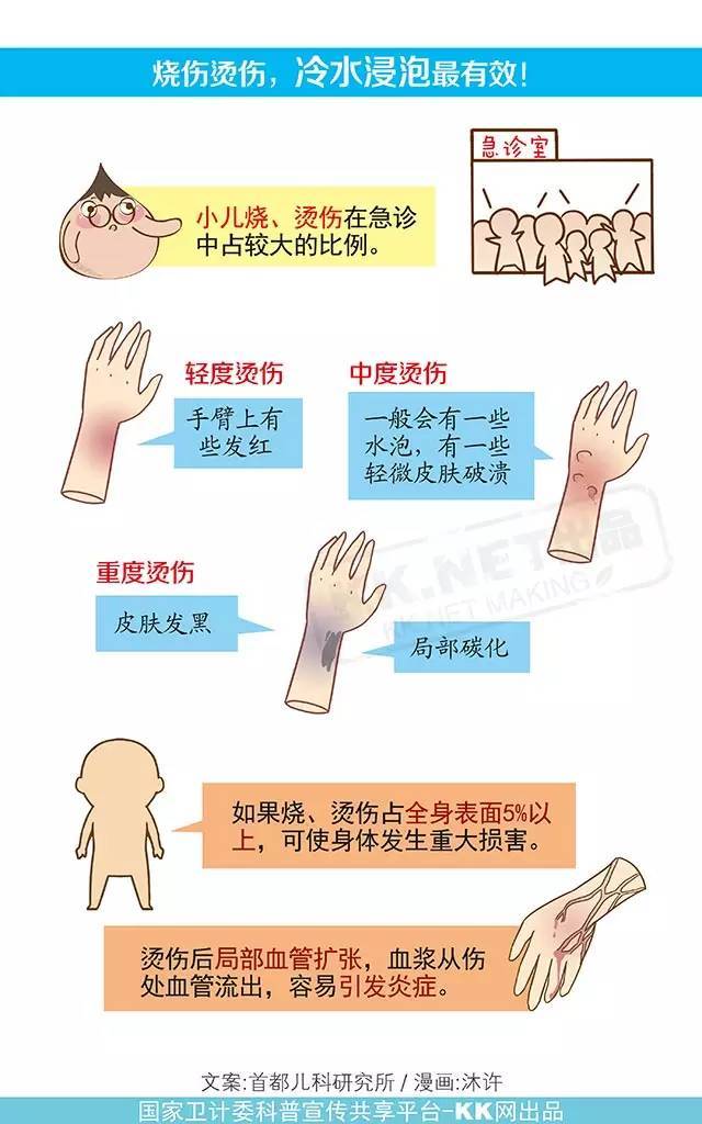 【健康促进】 宝宝烧伤烫伤,如何应急处理?