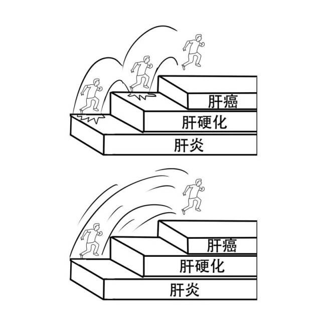 不仅如此,相较于肝炎三部曲来说, 脂肪肝的可怕之处在于,它会跳级, 有