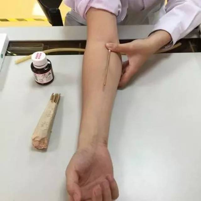 静脉血抽手腕图片