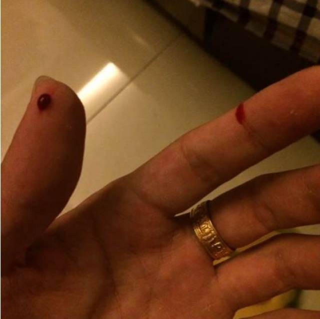 滴血莲花包浆后,真的能"滴血"!