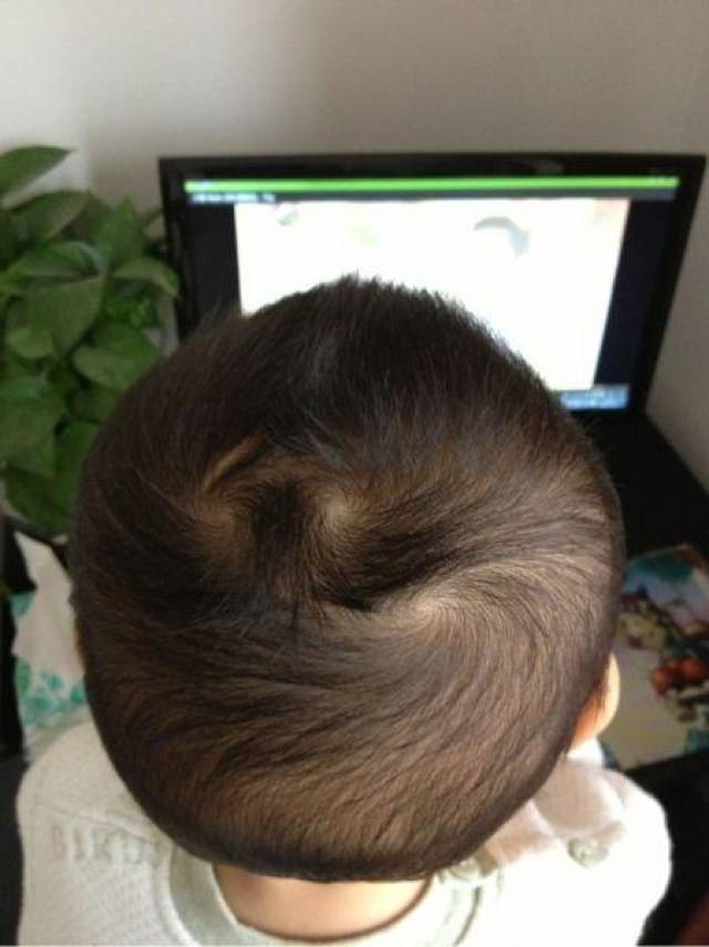 孩子"双发旋"会更聪明?