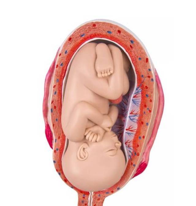 3,发现怀孕就必须正规医院诊疗,排除"剖宫产瘢痕妊娠".