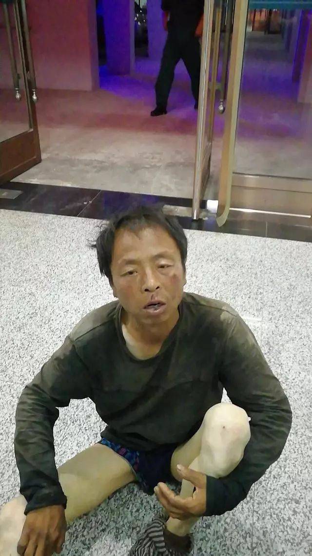 急寻家属:赤峰男子在辽宁被救助,自称叫刘树才,扩散助力他回家!