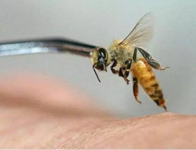 同被蜜蜂蛰,因处理方法不同,一人死一人生!医生呼吁转发此文,能救命!