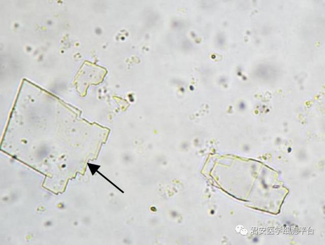 看图识细胞之"卫生部2017年尿液沉渣形态学质控"