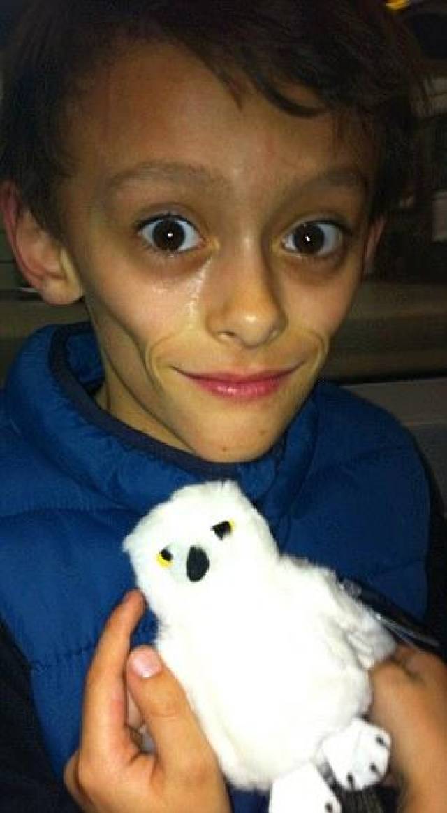 都是怪病惹的祸 英国11岁男孩酷似70岁老人