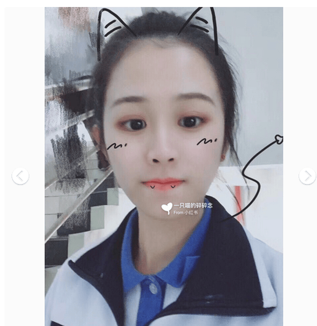 高中时期妈妈带我做了 日式无痕双眼皮南京