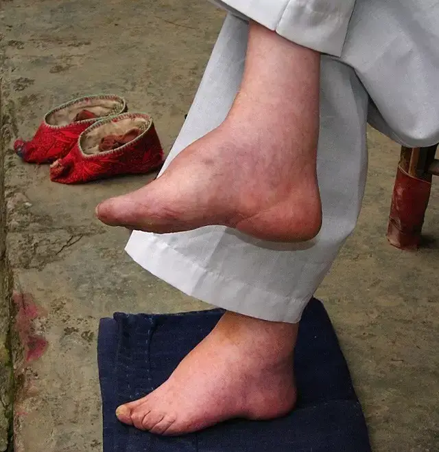 世界上最小的脚丫子图片