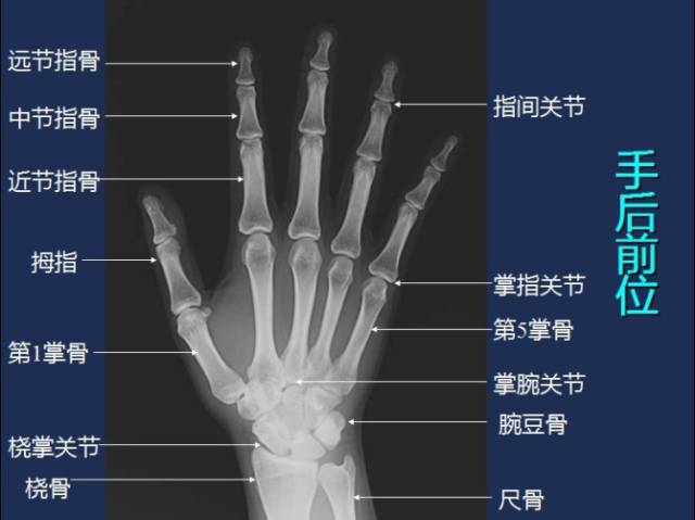 掌骨解剖图名称图片