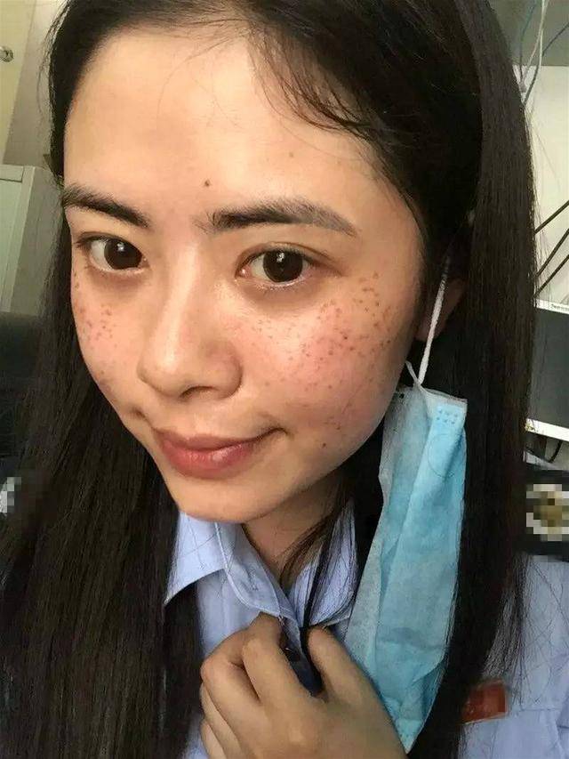 女人有斑会"显老"?巧用2种原液,抹一抹,能美白淡斑!_手机搜狐网