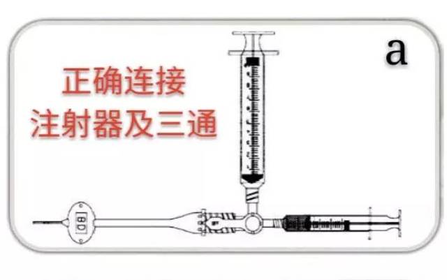 picc三通溶栓示意图图片