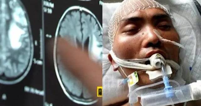 感染这种随处可见的"食脑虫",你可能必死无疑