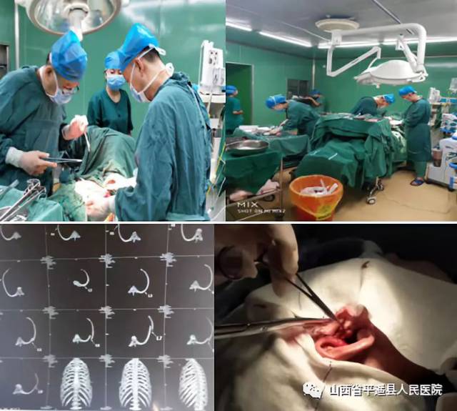 【平遥县人民医院随手拍】 环抱器内固定术