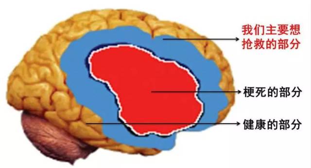 一文读懂脑灌注成像