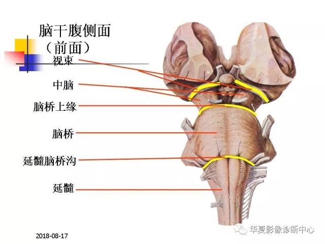 脑干网状结构解剖图图片