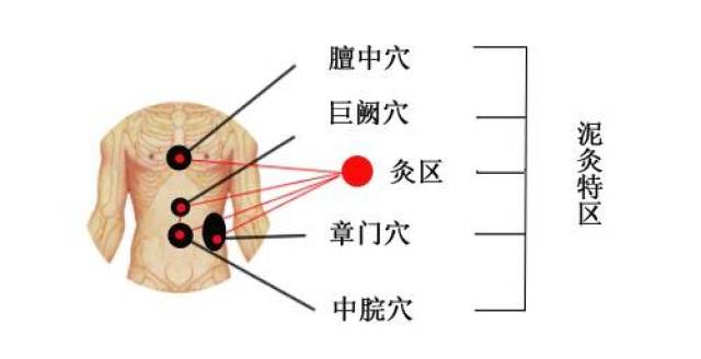 每天坚持揉按膻中,巨阙穴2-3次,每次大约2-3分钟即可,可达到防治及