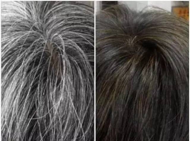 白发长黑发,白发变黑发,白发染黑发_文秘苑图库