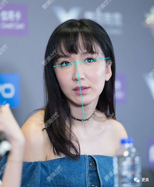 像娄艺潇这种偏颌的问题其实挺常见的,不少人都有这个困扰,连范冰冰也