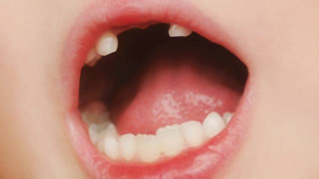 乳牙换牙需要找口腔医生吗?-健康频道-手机搜狐