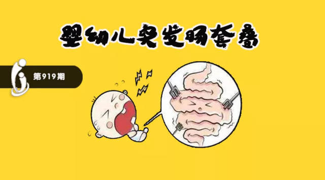 坚持继续5个月患儿先天性肛门闭锁手术后又遇上肠套叠
