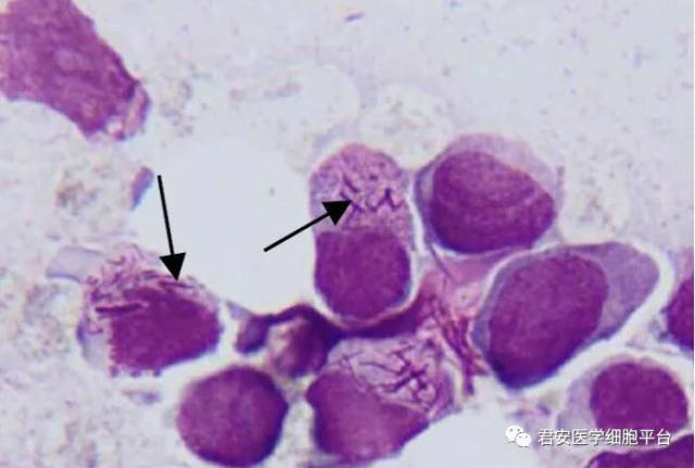 看图识细胞之"卫生部2018年第2次血细胞形态学质控"_手机搜狐网