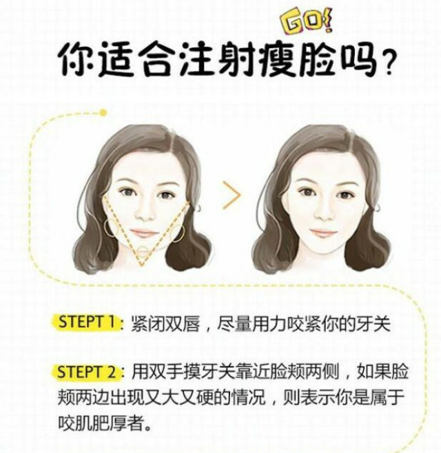 瘦脸针打完会肿吗