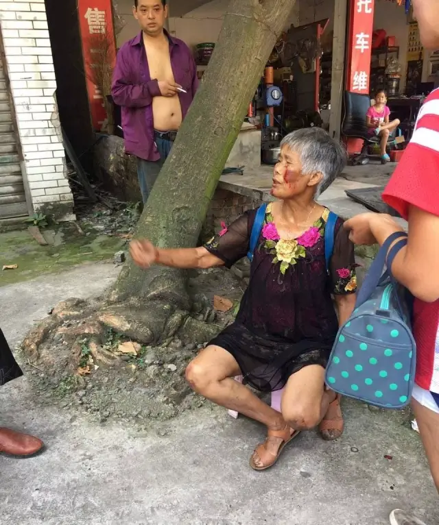 老太太還心有餘悸的向圍觀群眾講述事發經過,一臉害怕的表情真讓人