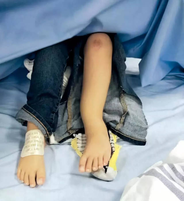 4岁女童跳弹床脚踝骨折_手机搜狐网